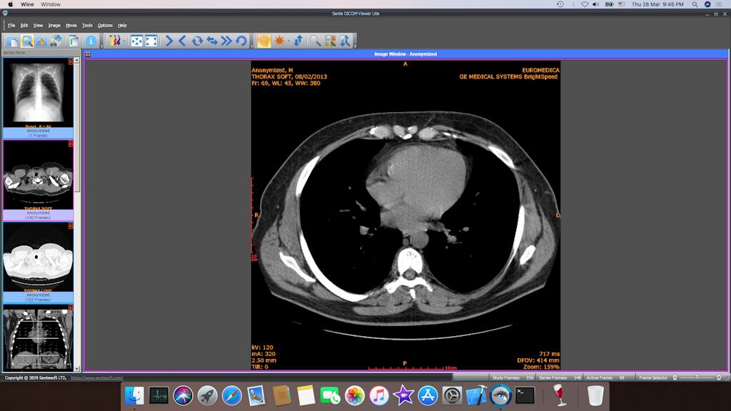 free download dicom image viewer for mac